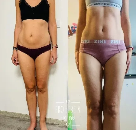 imgi 493 498614121 1278505774275647 222808852741554185 n